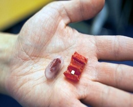New pill-sized robots to help stomach issues